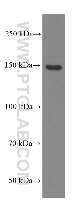 Western Blot (WB) analysis of HSC-T6 cells using PLCB3 Monoclonal antibody (66668-1-Ig)