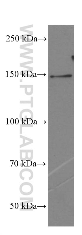 Western Blot (WB) analysis of NIH/3T3 cells using PLCB3 Monoclonal antibody (66668-1-Ig)