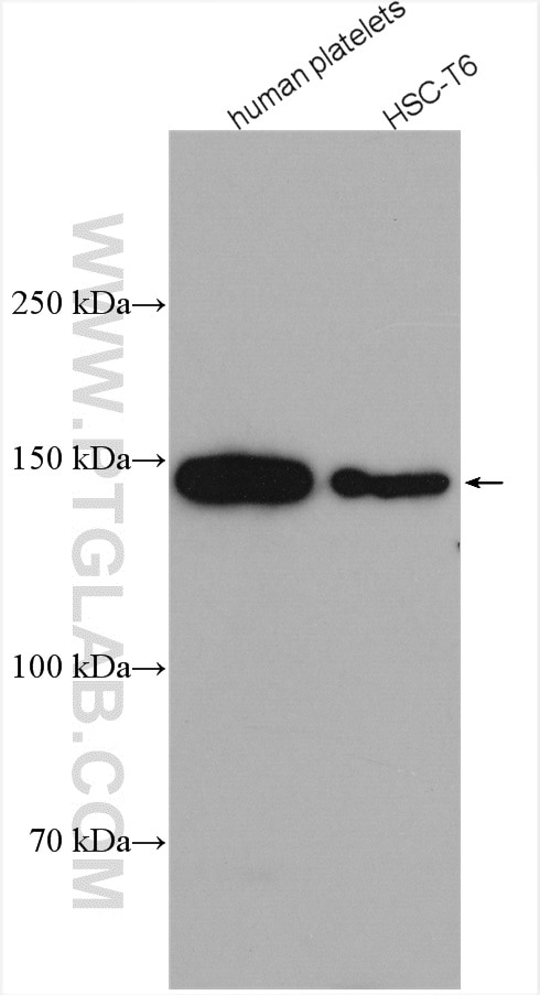 Western Blot (WB) analysis of various lysates using PLCB3 Monoclonal antibody (66668-1-Ig)