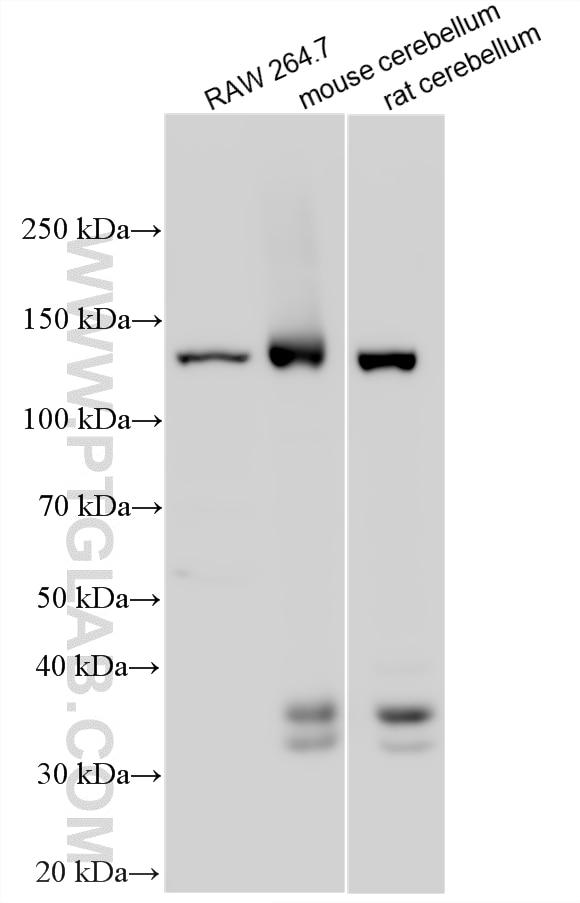WB analysis using 33683-1-AP Western Blot (WB) analysis of various lysates using PLCB4 Polyclonal antibody (33683-1-AP)