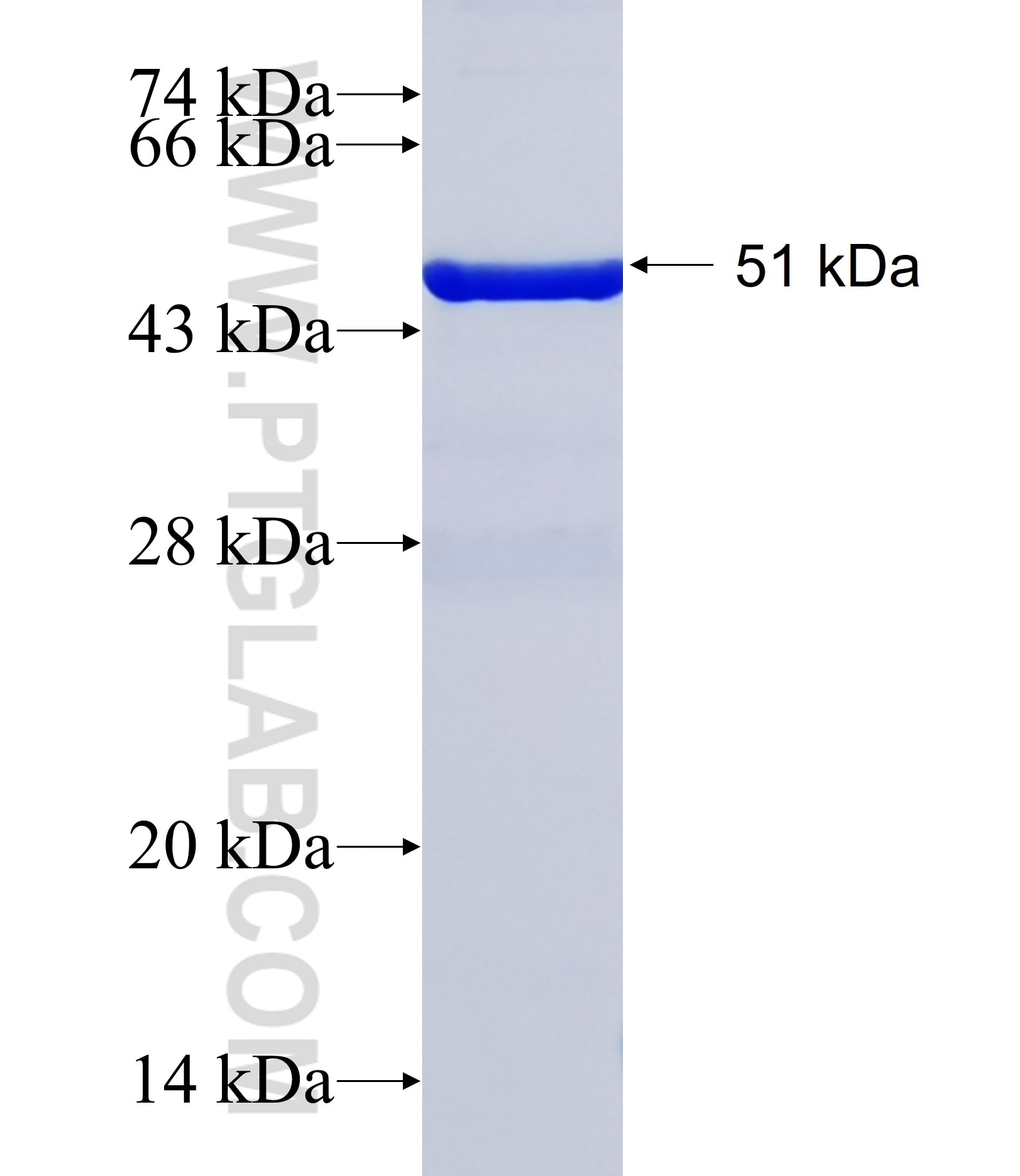 PLCB4 fusion protein Ag38268 SDS-PAGE