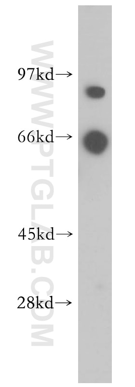 Western Blot (WB) analysis of human brain tissue using PLCD1 Polyclonal antibody (14228-1-AP)