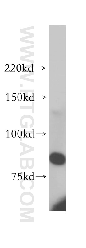 Western Blot (WB) analysis of human rectum tissue using PLCD1 Polyclonal antibody (14228-1-AP)