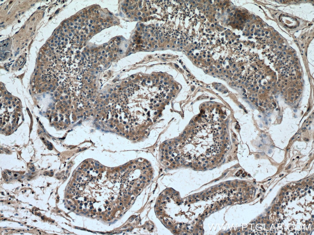 Immunohistochemistry (IHC) staining of human testis tissue using PLCD1 Monoclonal antibody (67064-1-Ig)