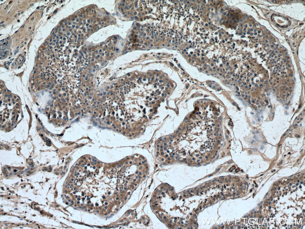 IHC staining of human testis using 67064-1-Ig