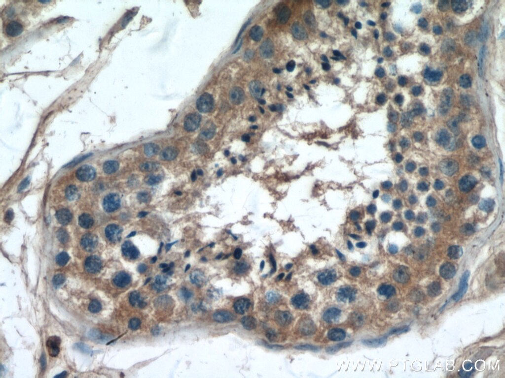 IHC staining of human testis using 67064-1-Ig