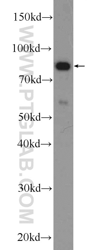 Western Blot (WB) analysis of A549 cells using PLCD3 Polyclonal antibody (16792-1-AP)