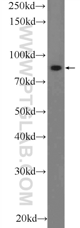 Western Blot (WB) analysis of SH-SY5Y cells using PLCD3 Polyclonal antibody (16792-1-AP)