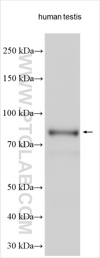 Western Blot (WB) analysis of various lysates using PLCD4 Polyclonal antibody (30133-1-AP)