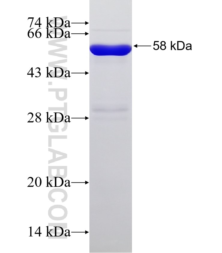 PLCD4 fusion protein Ag32651 SDS-PAGE