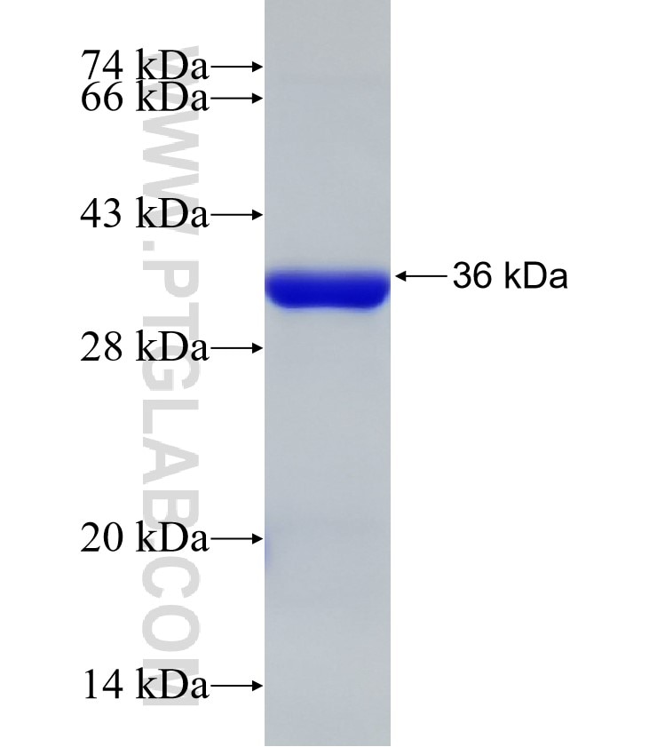 PLCD4 fusion protein Ag32676 SDS-PAGE PLCD4 fusion protein Ag32676 SDS-PAGE