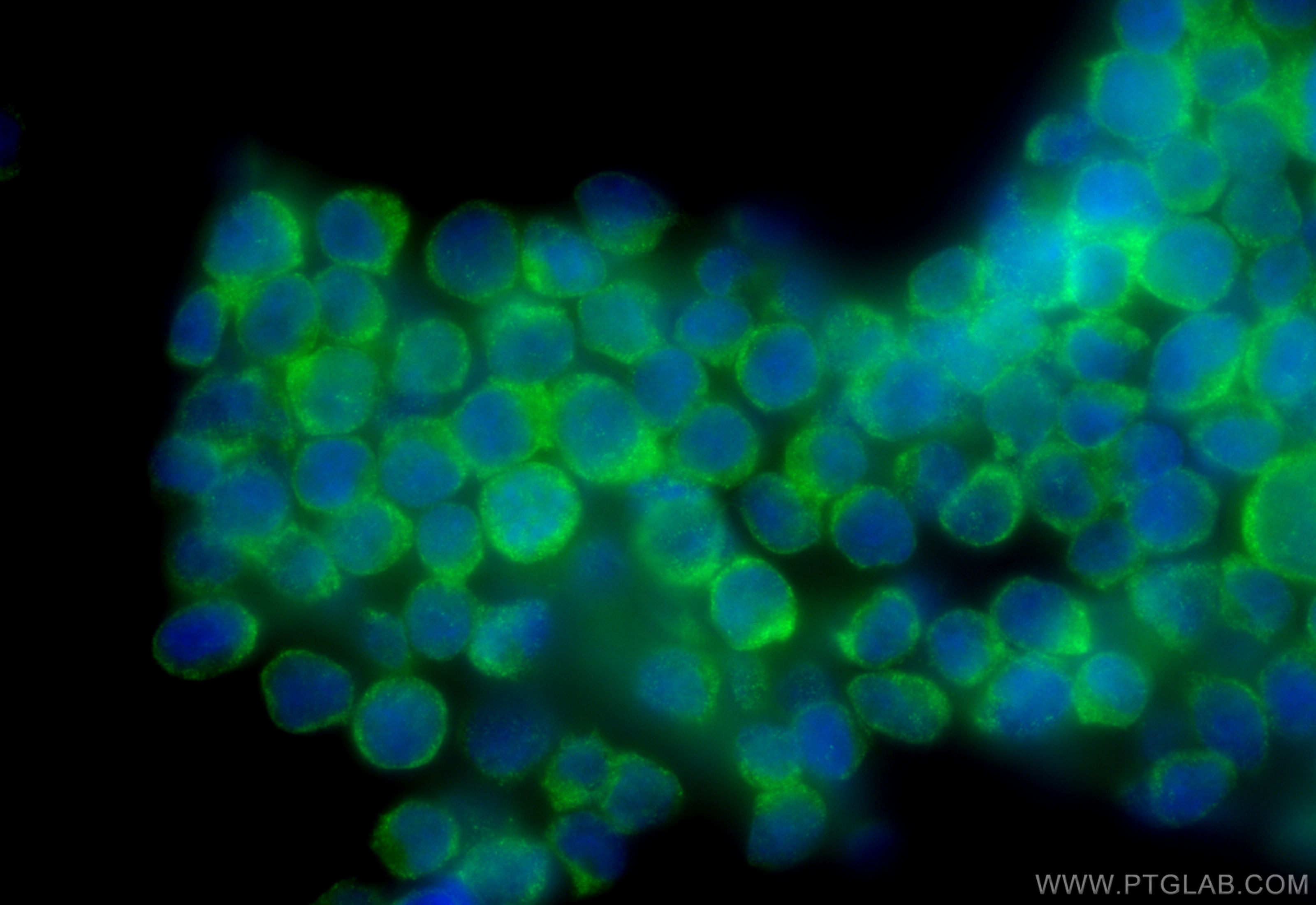 Immunofluorescence (IF) / fluorescent staining of Jurkat cells using PLCG1 Polyclonal antibody (28362-1-AP)
