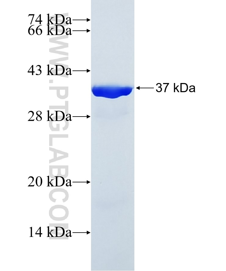 PLCG1 fusion protein Ag27218 SDS-PAGE
