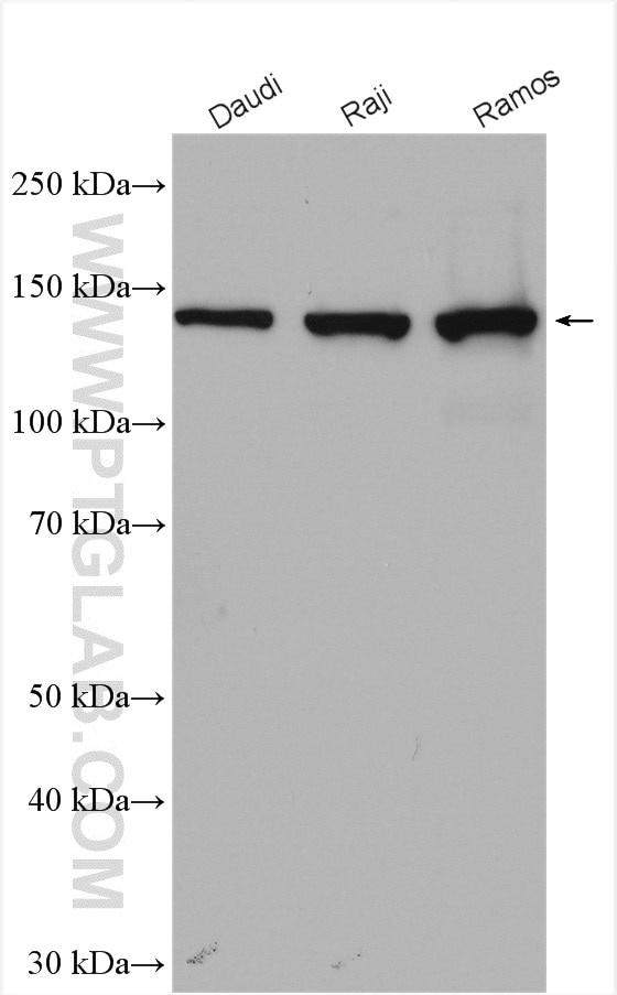 Western Blot (WB) analysis of various lysates using PLCG2 Polyclonal antibody (27173-1-AP)