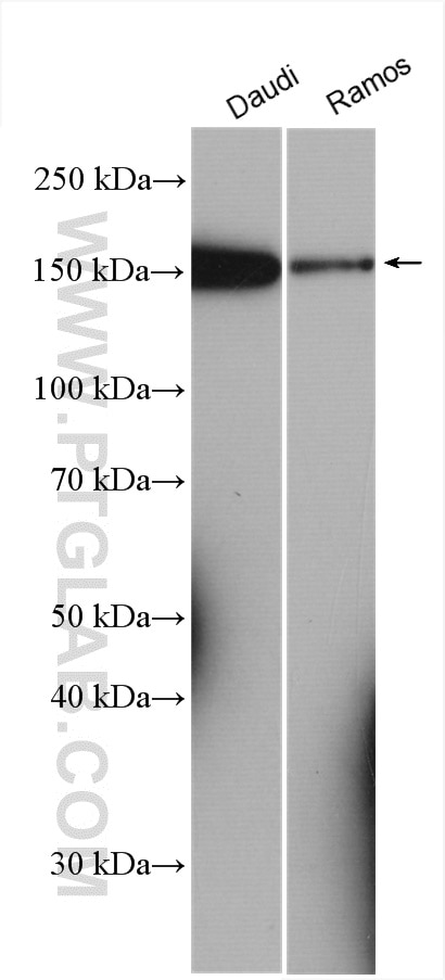 Western Blot (WB) analysis of various lysates using PLCG2 Polyclonal antibody (29567-1-AP)