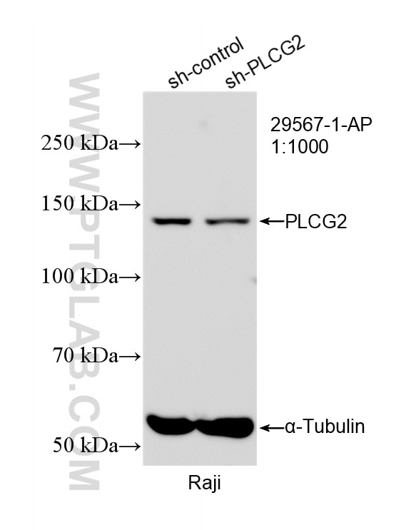 Western Blot (WB) analysis of Raji cells using PLCG2 Polyclonal antibody (29567-1-AP)