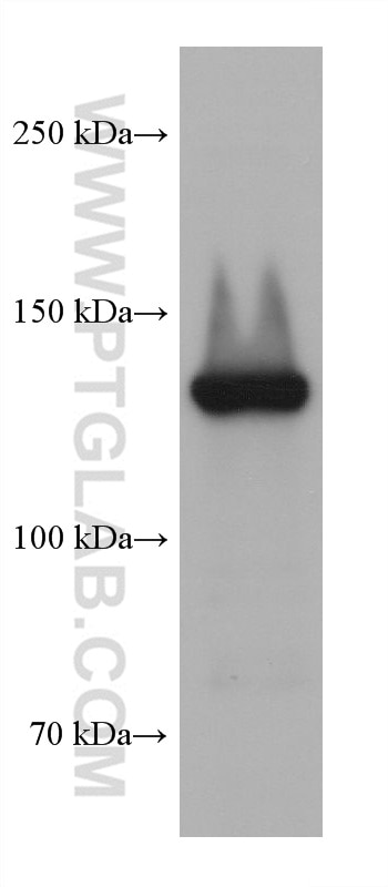 Western Blot (WB) analysis of Karpas-422 cells using PLCG2 Monoclonal antibody (67011-1-Ig)