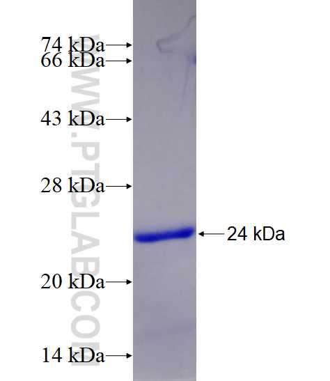 PLCG2 fusion protein Ag24355 SDS-PAGE