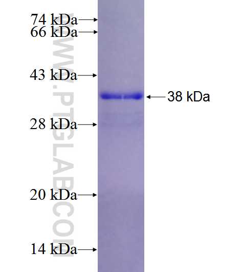 PLCG2 fusion protein Ag25847 SDS-PAGE
