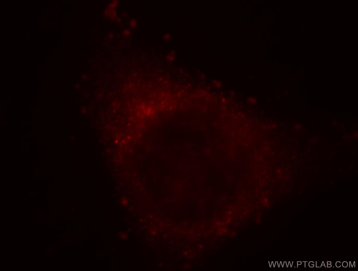 IF Staining of HepG2 using 19143-1-AP