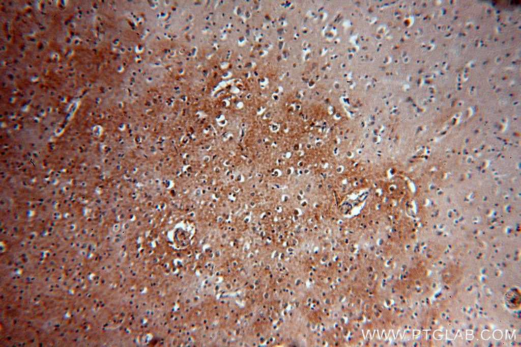 Immunohistochemistry (IHC) staining of human brain tissue using PLCH1 Polyclonal antibody (19143-1-AP)