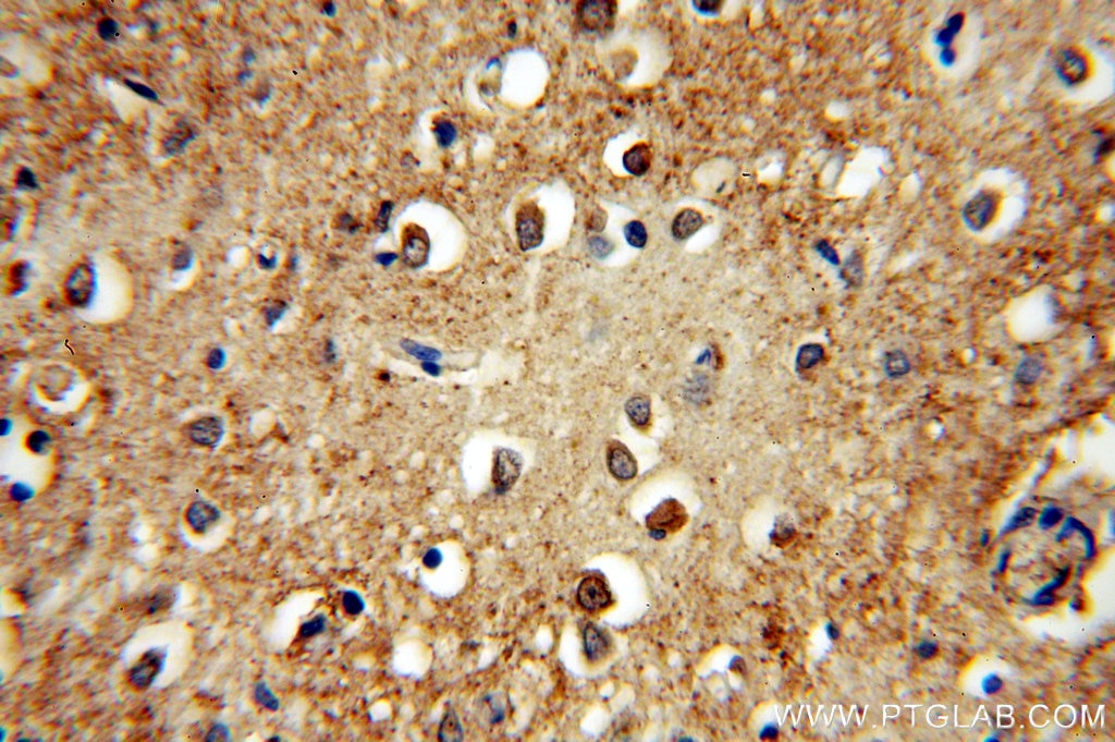Immunohistochemistry (IHC) staining of human brain tissue using PLCH1 Polyclonal antibody (19143-1-AP)