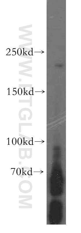 Western Blot (WB) analysis of SH-SY5Y cells using PLCH1 Polyclonal antibody (19143-1-AP)