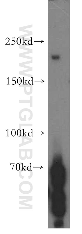 Western Blot (WB) analysis of HEK-293 cells using PLCH1 Polyclonal antibody (19143-1-AP)