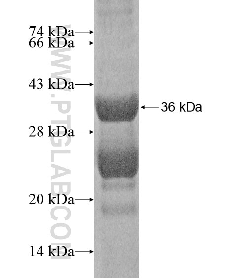 PLCL1 fusion protein Ag20105 SDS-PAGE
