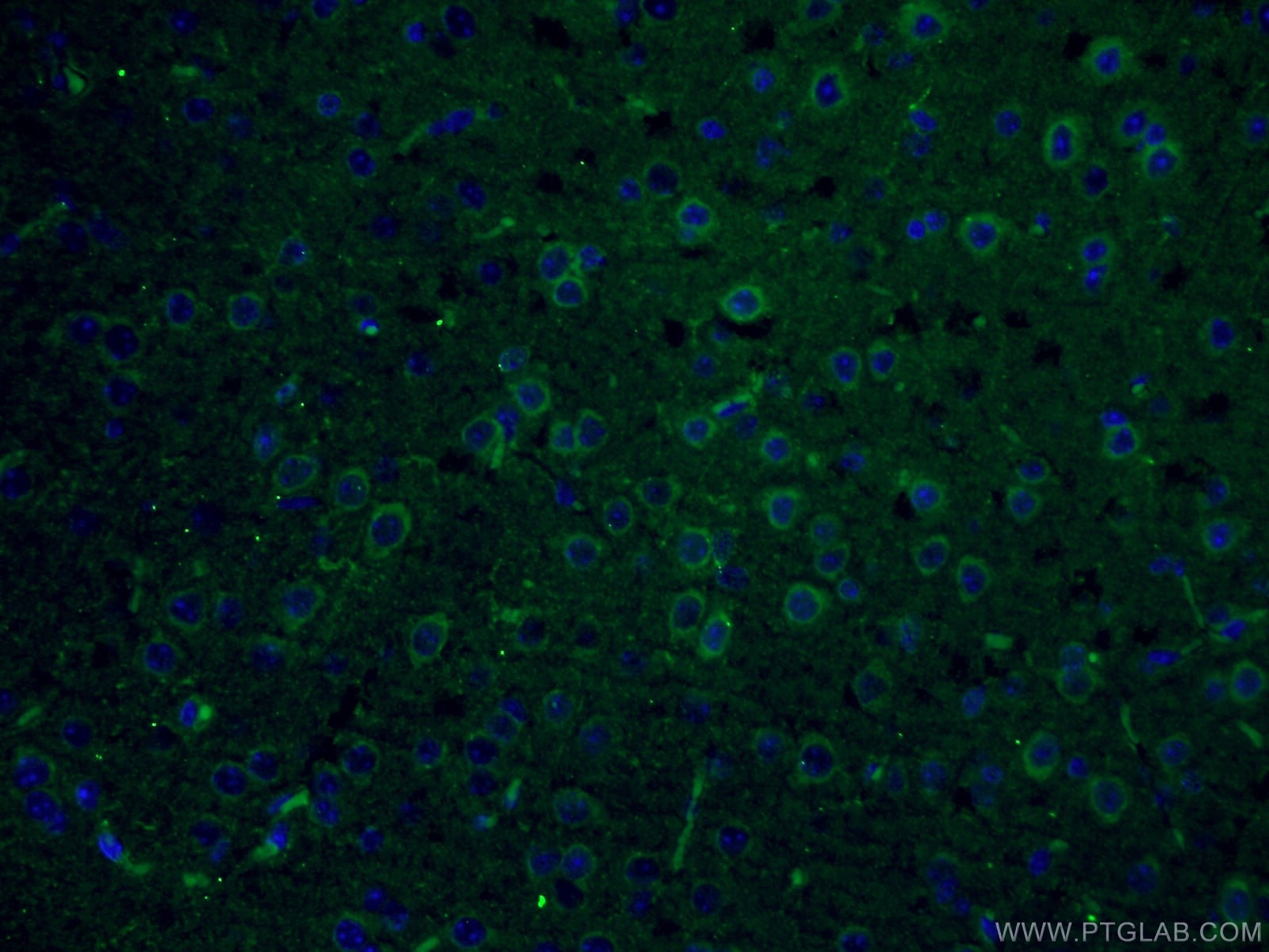 Immunofluorescence (IF) / fluorescent staining of mouse brain tissue using PLCL2 Polyclonal antibody (17421-1-AP)
