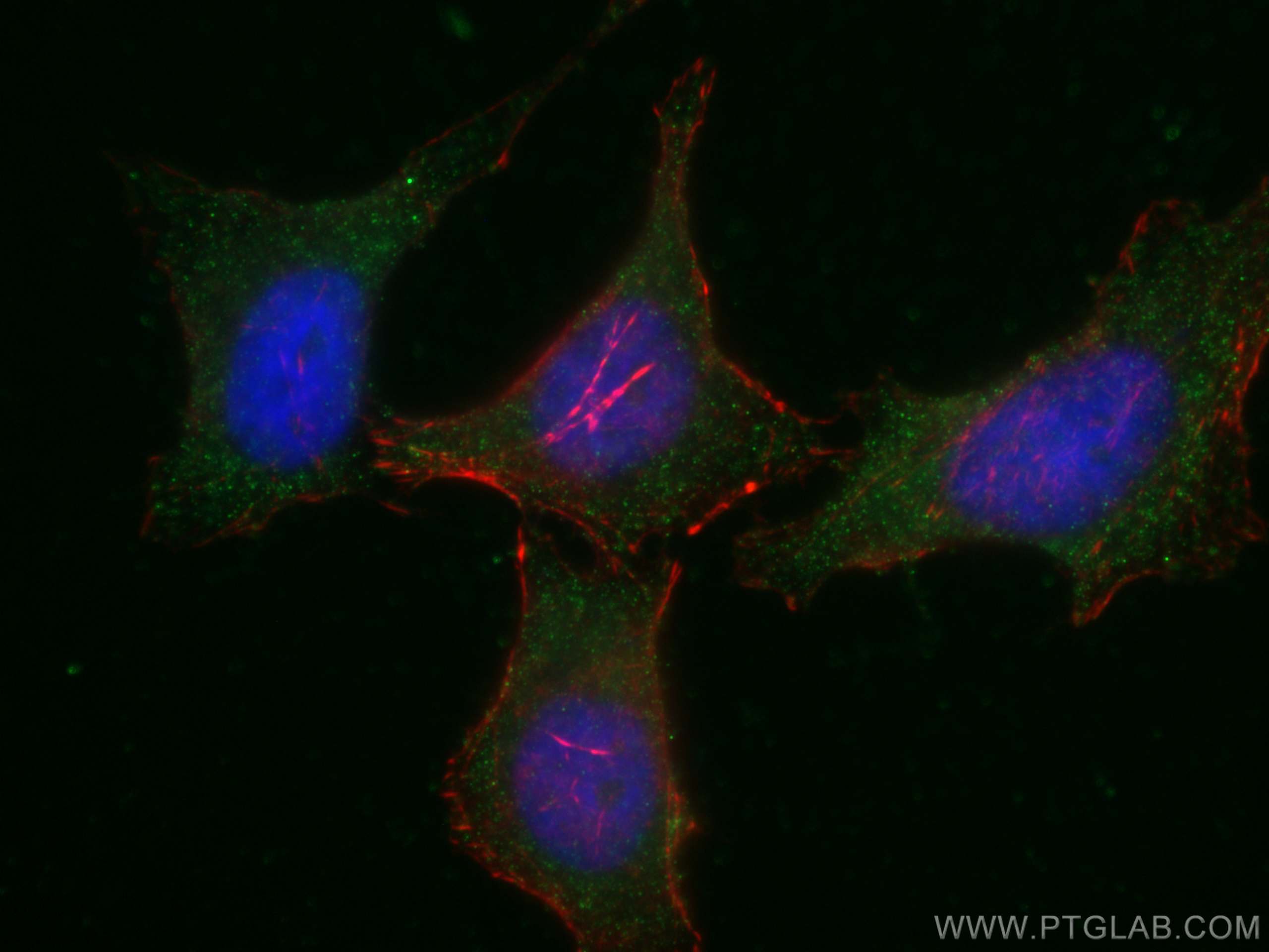 Immunofluorescence (IF) / fluorescent staining of HeLa cells using PLCL2 Monoclonal antibody (67471-1-Ig)