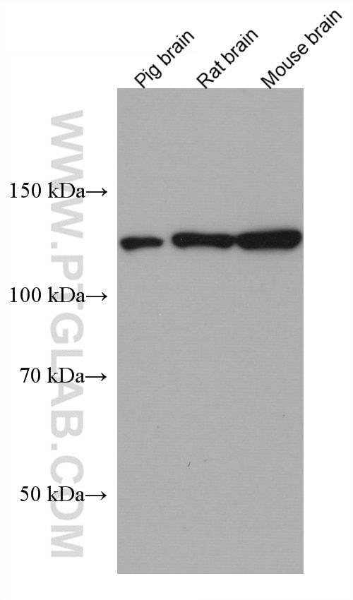 Western Blot (WB) analysis of various lysates using PLCL2 Monoclonal antibody (67471-1-Ig)
