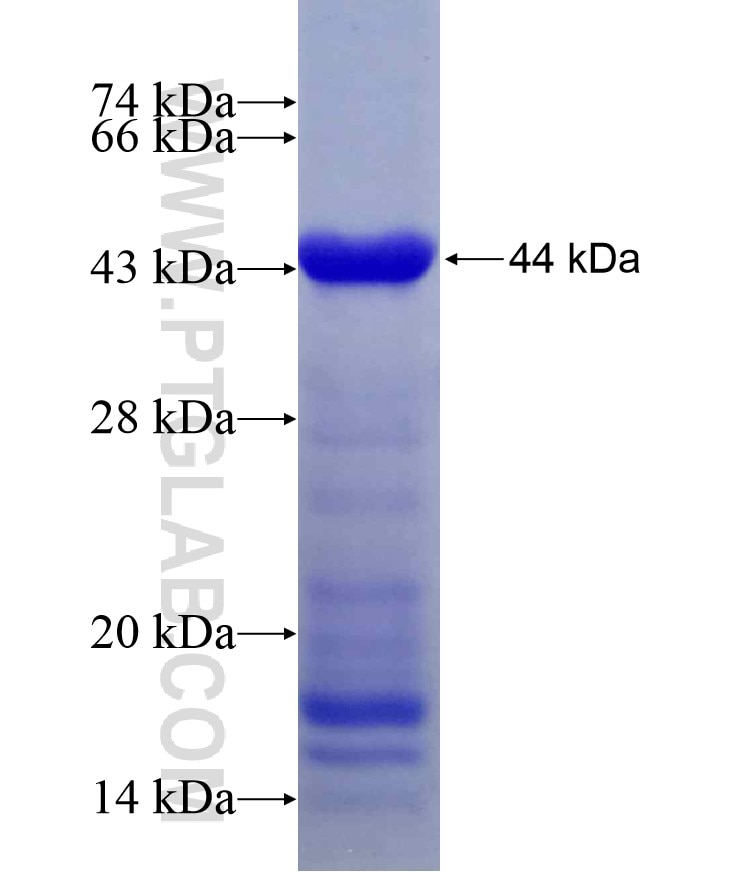 PLCL2 fusion protein Ag11461 SDS-PAGE