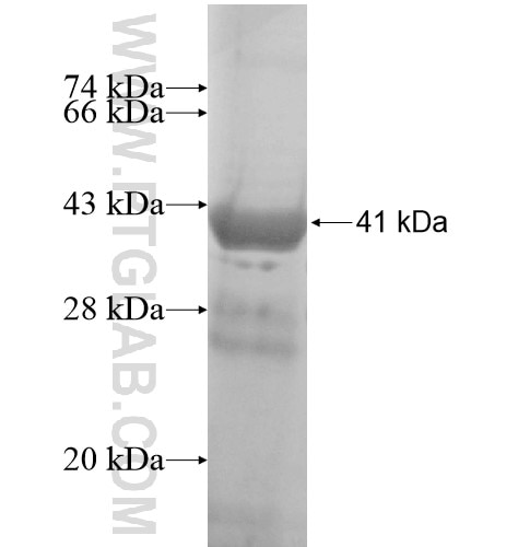 PLCXD1 fusion protein Ag15101 SDS-PAGE