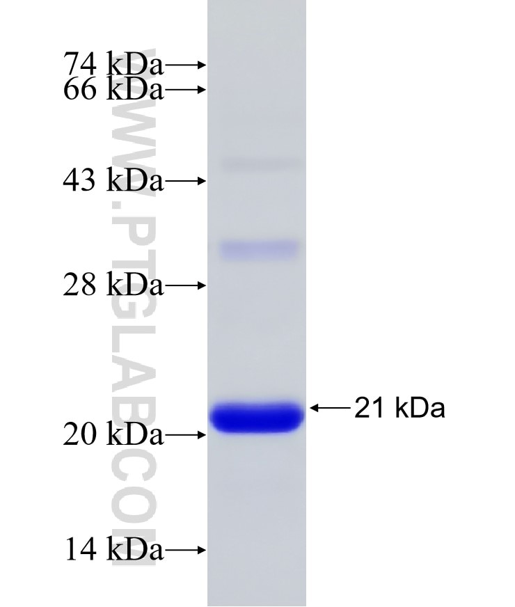 PLCXD2 fusion protein Ag27647 SDS-PAGE