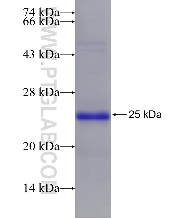 PLCZ1 fusion protein Ag26899 SDS-PAGE