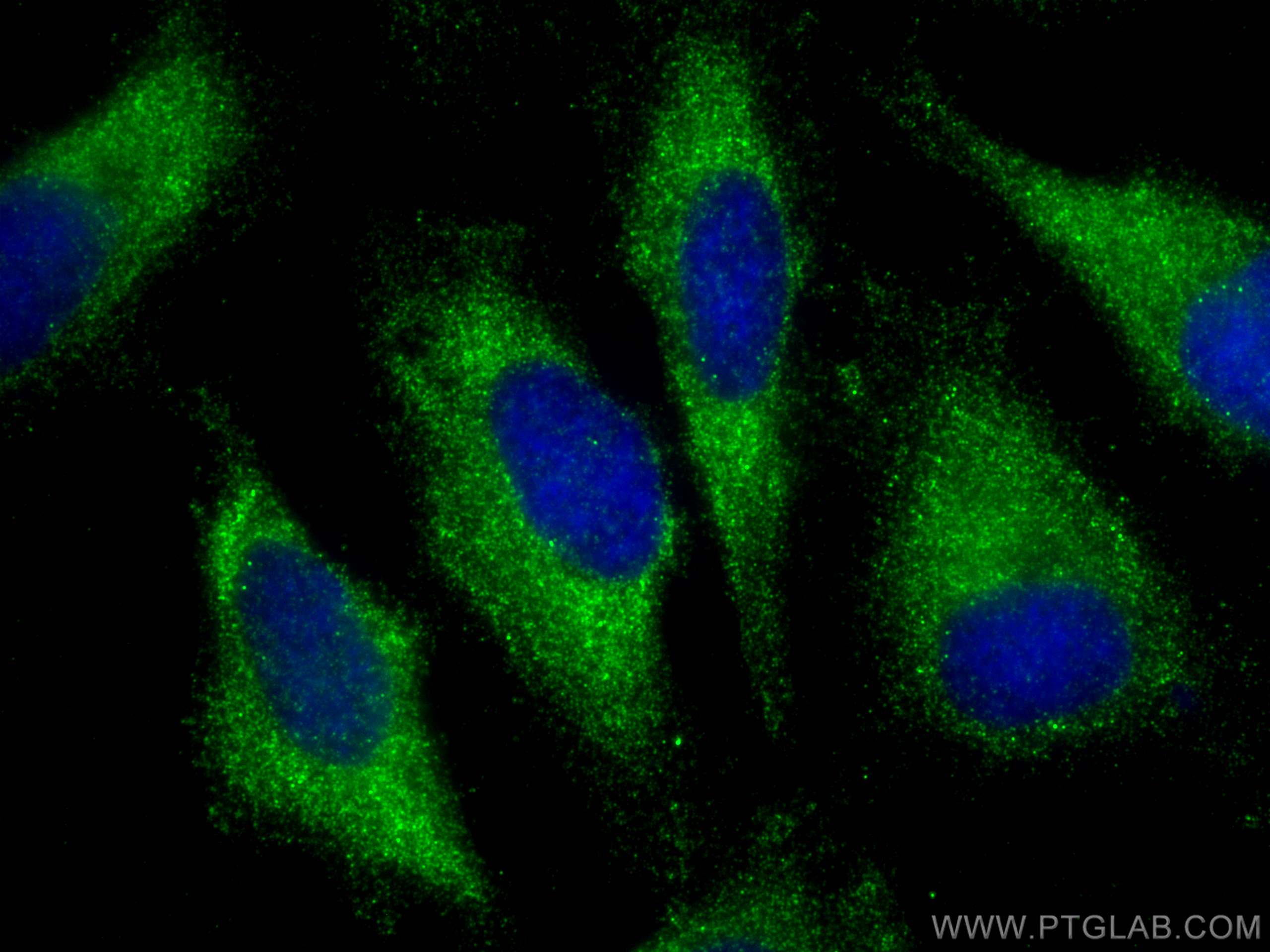 Immunofluorescence (IF) / fluorescent staining of HeLa cells using PLD1 Polyclonal antibody (18355-1-AP)
