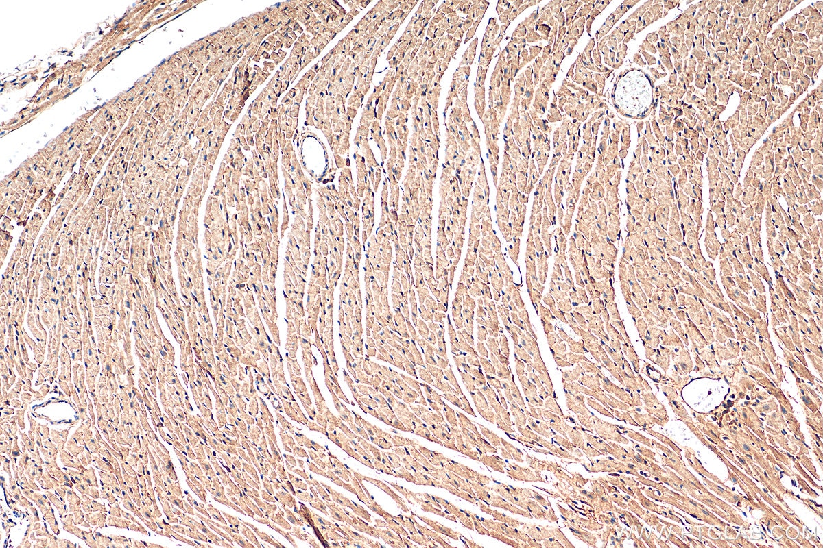 IHC staining of mouse heart using 18355-1-AP