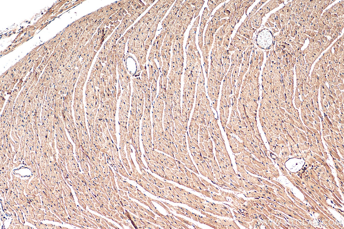 Immunohistochemistry (IHC) staining of mouse heart tissue using PLD1 Polyclonal antibody (18355-1-AP)