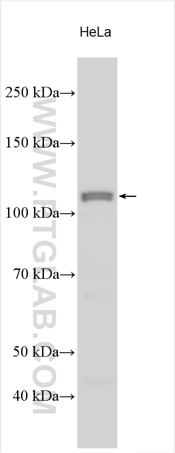 Western Blot (WB) analysis of various lysates using PLD1 Polyclonal antibody (18355-1-AP)