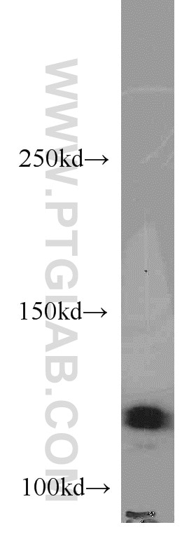 PLD1 Polyclonal antibody