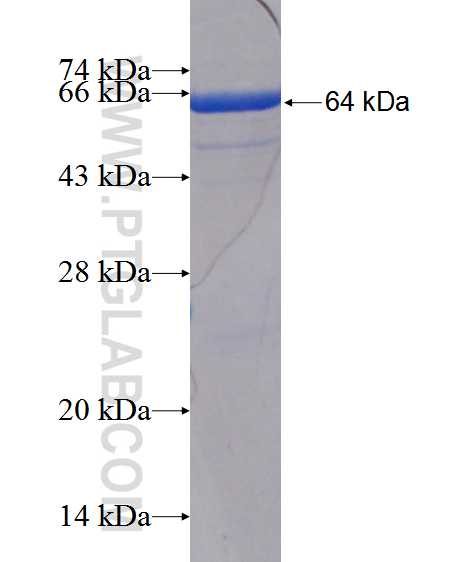 PLD1 fusion protein Ag11945 SDS-PAGE