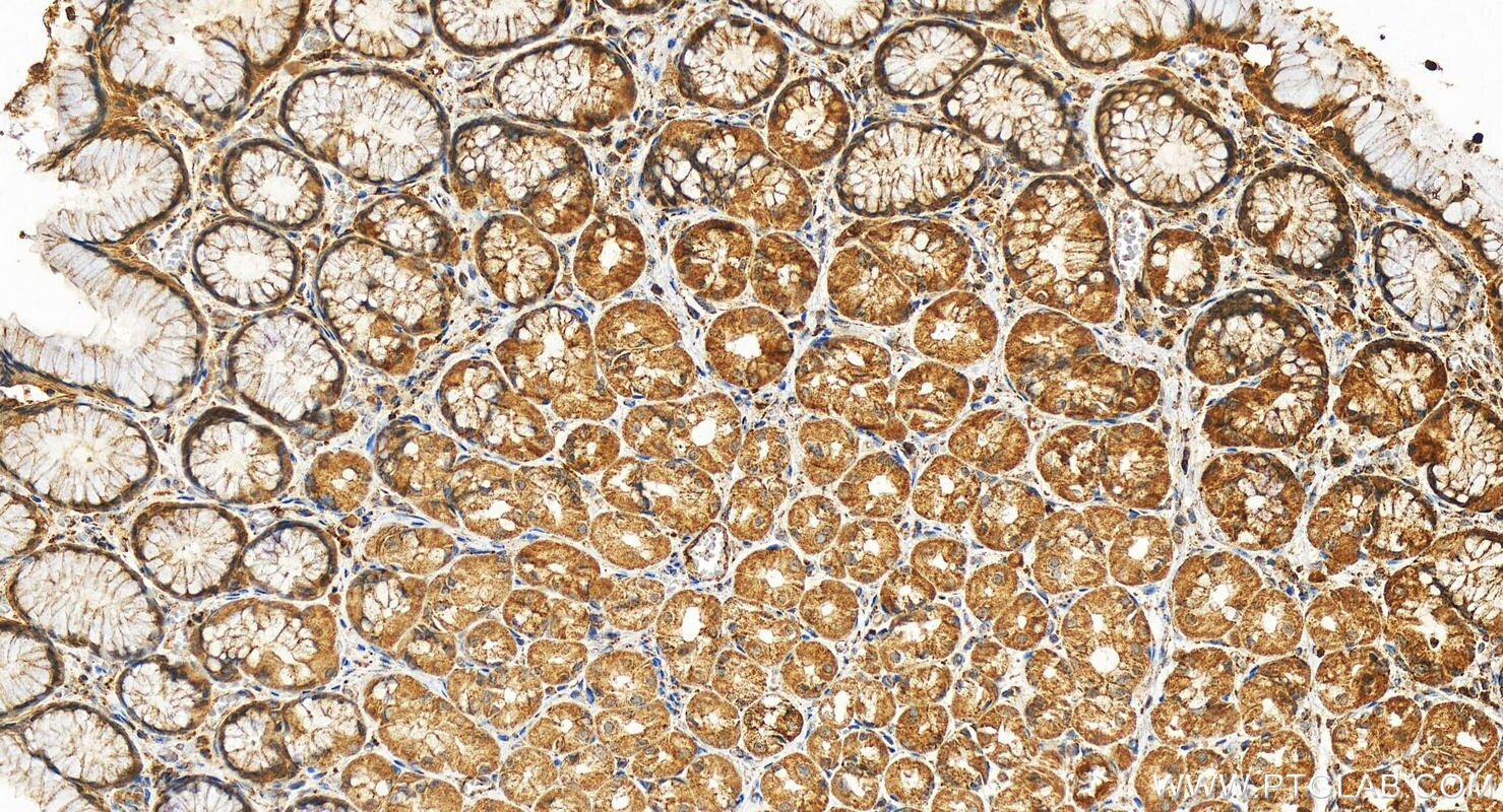 Immunohistochemistry (IHC) staining of human stomach tissue using PLD3 Polyclonal antibody (17327-1-AP)