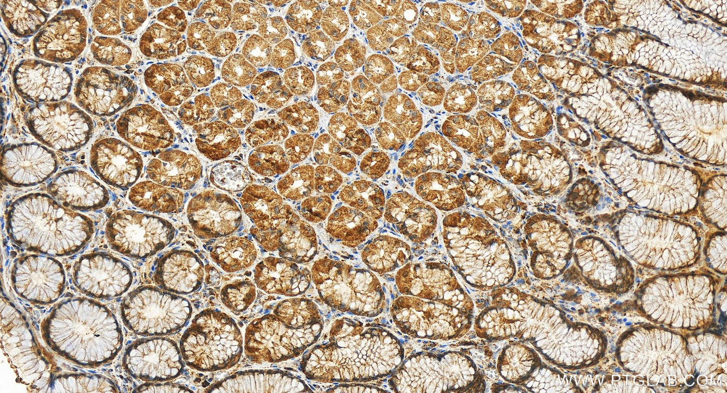 Immunohistochemistry (IHC) staining of human stomach tissue using PLD3 Polyclonal antibody (17327-1-AP)