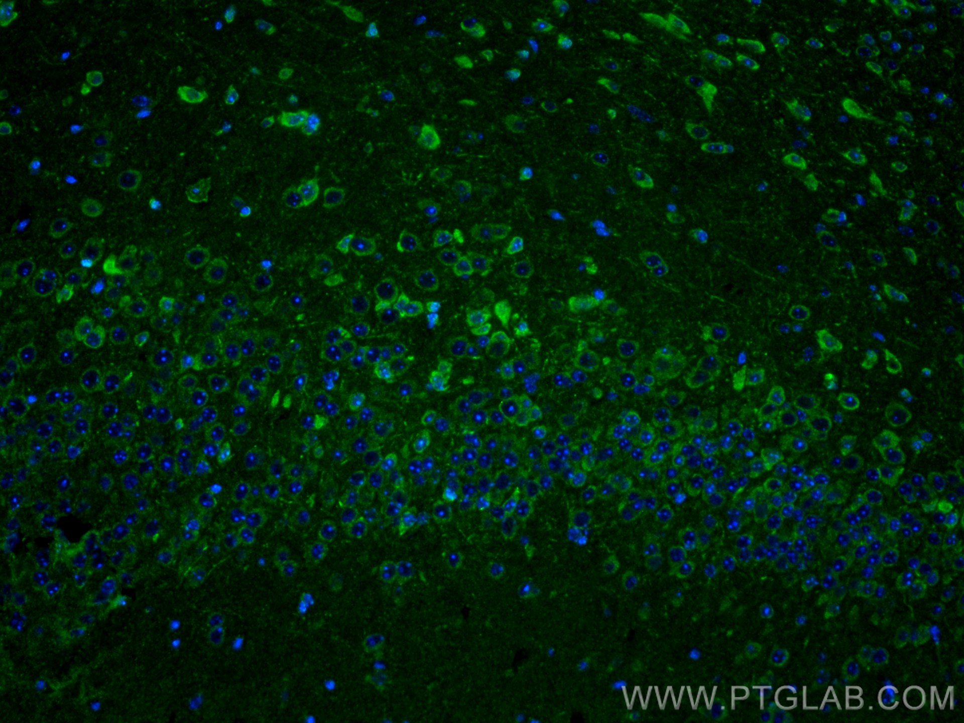 Immunofluorescence (IF) / fluorescent staining of mouse brain tissue using PLD3 Polyclonal antibody (17327-1-AP)