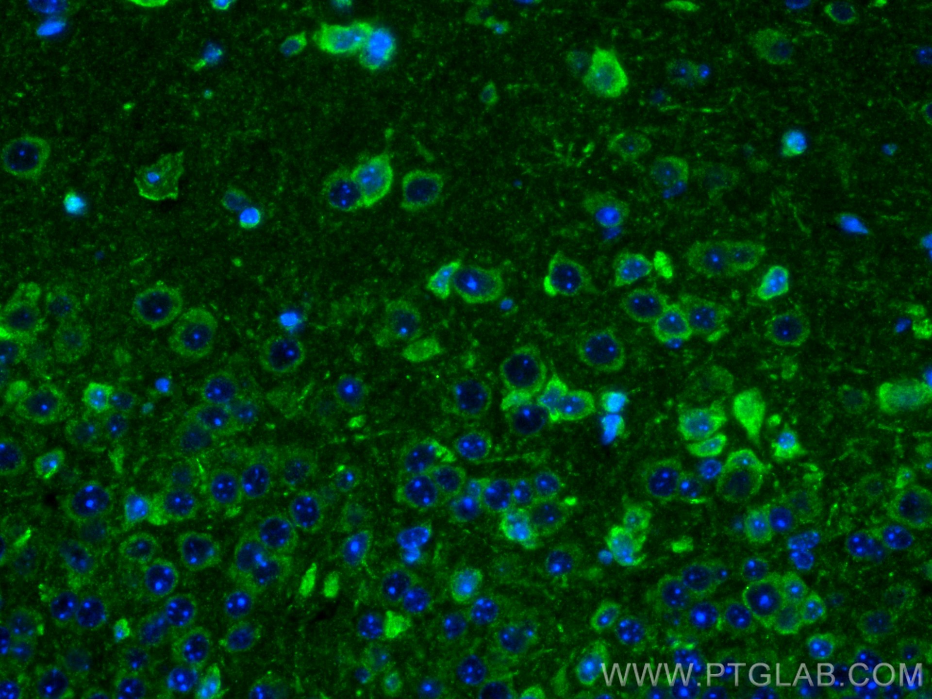 Immunofluorescence (IF) / fluorescent staining of mouse brain tissue using PLD3 Polyclonal antibody (17327-1-AP)
