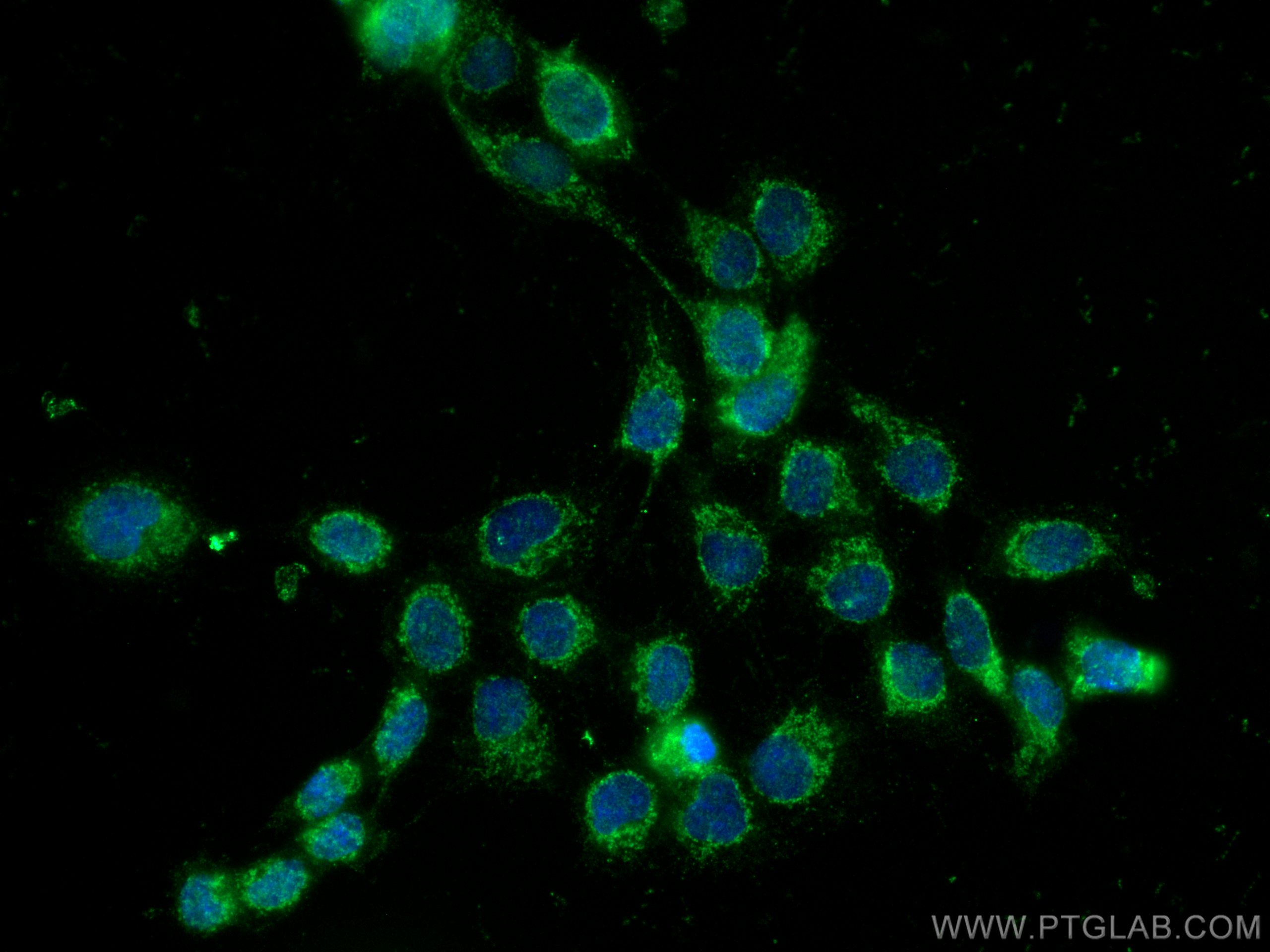 Immunofluorescence (IF) / fluorescent staining of A431 cells using PLD3 Polyclonal antibody (17327-1-AP)