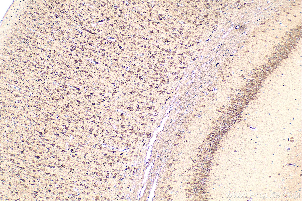 Immunohistochemistry (IHC) staining of mouse brain tissue using PLD3 Polyclonal antibody (17327-1-AP)