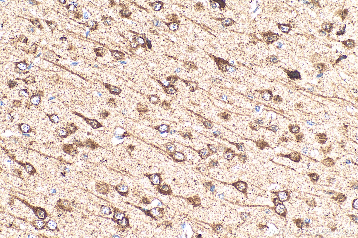 Immunohistochemistry (IHC) staining of mouse brain tissue using PLD3 Polyclonal antibody (17327-1-AP)