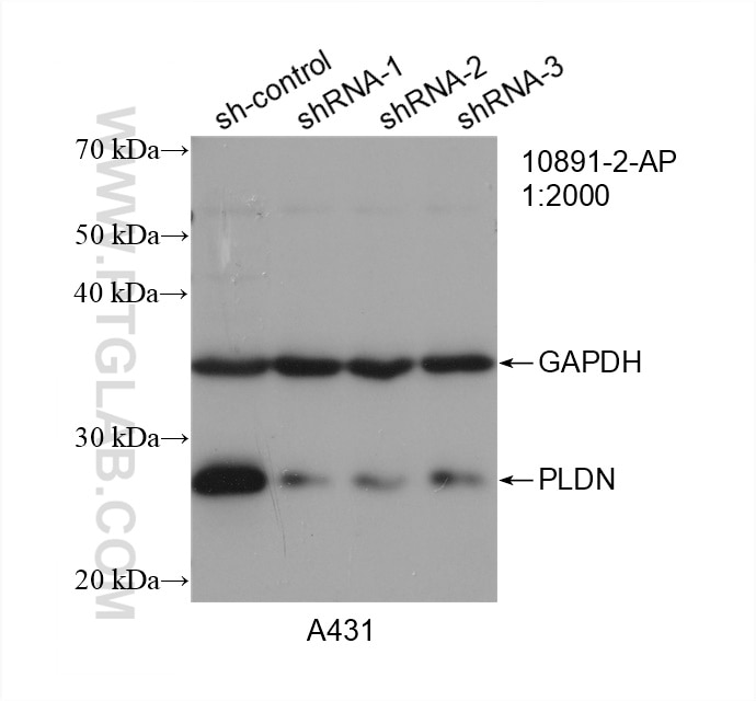 Western Blot (WB) analysis of A431 cells using PLDN Polyclonal antibody (10891-2-AP)